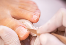 How Medical Pedicures Help Patients with Chronic Foot Pain